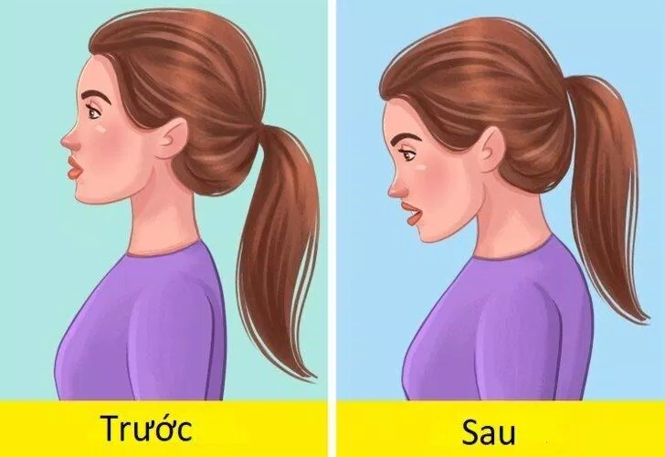 Tin xấu là bạn có thể bị gù nữa! (Ảnh: Internet) Tin xấu là bạn có thể bị gù nữa! (Ảnh: Internet)