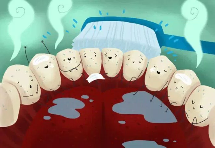 Cẩn thận với các bệnh răng miệng như viêm lợi, sâu răng khi thở bằng miệng (Ảnh: Internet)
