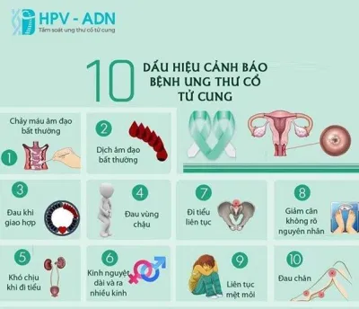 Dấu hiệu nghi ngờ ung thư cổ tử cung (Ảnh: Internet). Dấu hiệu nghi ngờ ung thư cổ tử cung (Ảnh: Internet).