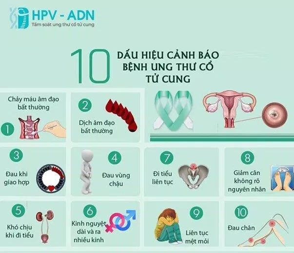 Dấu hiệu nghi ngờ ung thư cổ tử cung (Ảnh: Internet). Dấu hiệu nghi ngờ ung thư cổ tử cung (Ảnh: Internet).