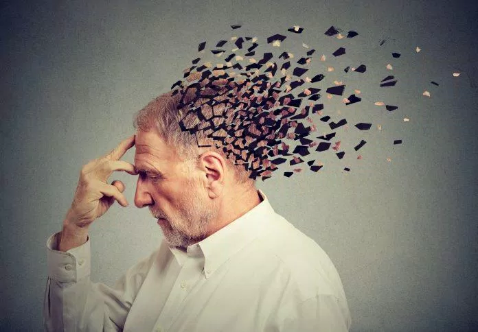 Bệnh Alzheimer gây suy giảm trí nhớ, suy nghĩ và hành vi (ảnh: Internet)