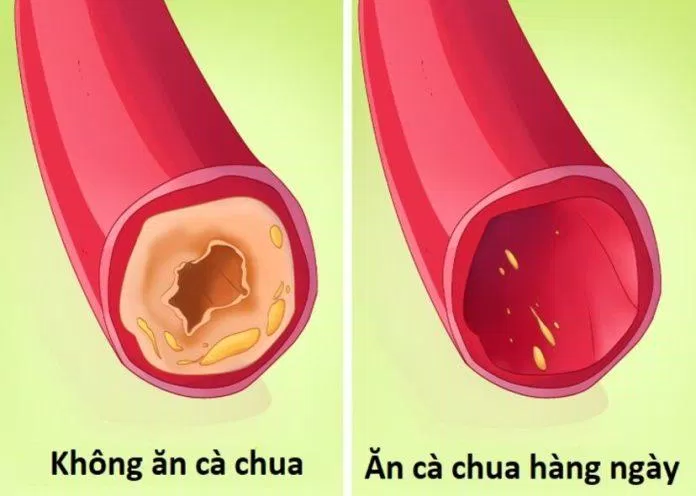 Cà chua có tác dụng phòng chống các bệnh liên quan đến tim mạch (Ảnh: Internet) Cà chua có tác dụng phòng chống các bệnh liên quan đến tim mạch (Ảnh: Internet)