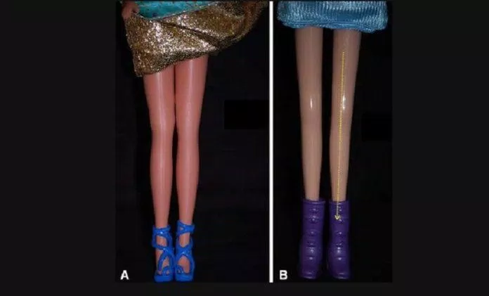 Hai kiểu chân của búp bê Barbie (Ảnh: Internet).