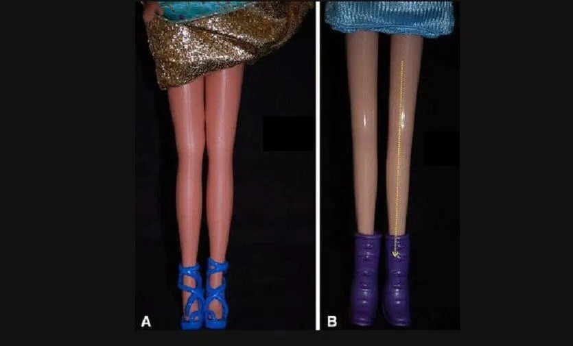 Hai kiểu chân của búp bê Barbie (Ảnh: Internet). Hai kiểu chân của búp bê Barbie (Ảnh: Internet).