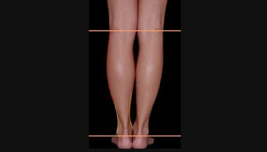 Các đường cong của chân (Ảnh: Internet). Các đường cong của chân (Ảnh: Internet).