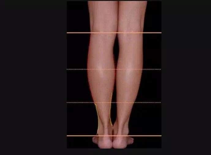 Đôi chân đẹp là như thế nào? Đi tìm “công thức” từ những đôi chân đẹp nổi tiếng thế giới - BlogAnChoi