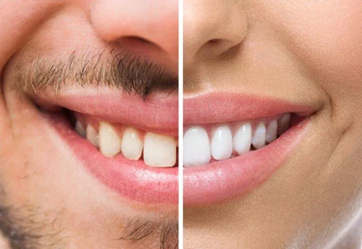 Chỉ cần nhìn vào hàm cũng có thể phân biệt được giới tính (Ảnh: Internet) Chỉ cần nhìn vào hàm cũng có thể phân biệt được giới tính (Ảnh: Internet)