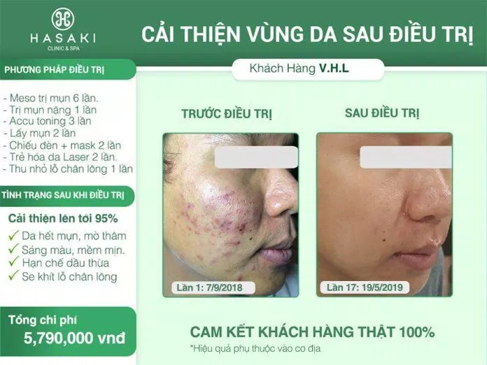 Một liệu trình tại Hasaki Clinic & Spa