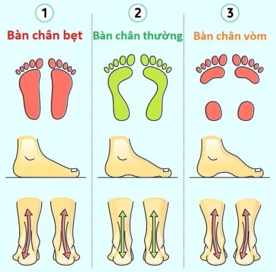 Việc xác định được kiểu bàn chân sẽ thuận tiện cho lúc mua giày hơn (Ảnh: Internet)