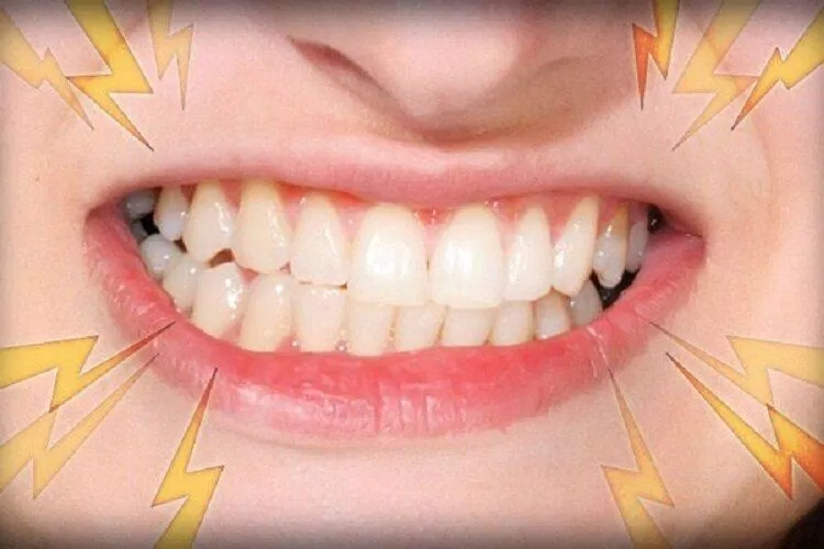 Nghiến răng có thể gây hại rất nghiêm trọng (Nguồn: Internet) Nghiến răng có thể gây hại rất nghiêm trọng (Nguồn: Internet)