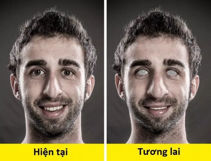 Tổng hợp những thay đổi trên khuôn mặt nam giới trong tương lai (Ảnh: Internet)