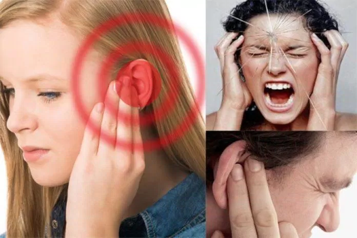 Bấm huyệt ở tai chữa đau đầu (Nguồn: Internet) Bấm huyệt ở tai chữa đau đầu (Nguồn: Internet)