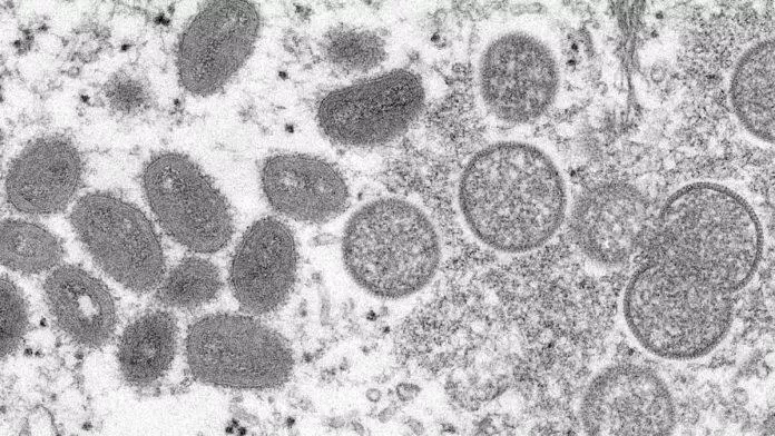 Virus gây bệnh đậu mùa khỉ nhìn dưới kính hiển vi (Ảnh: Internet).