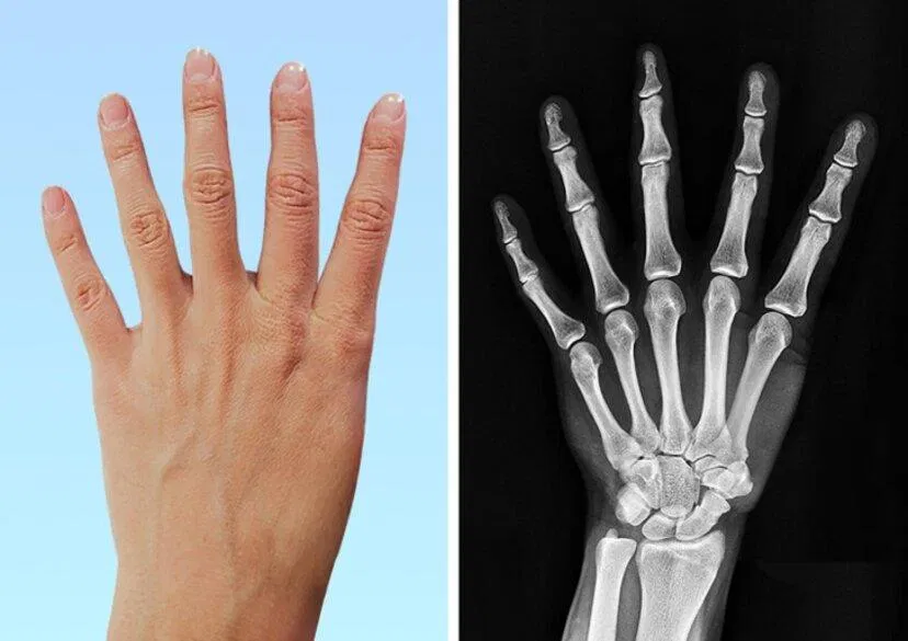 Đây là một đột biến cực hiếm, tuy nó không thể giúp bạn cứu thế giới được (Ảnh: Internet)