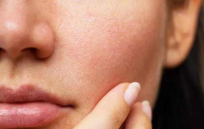Mỗi làn da cần một loại sữa rửa mặt phù hợp Mỗi làn da cần một loại sữa rửa mặt phù hợp