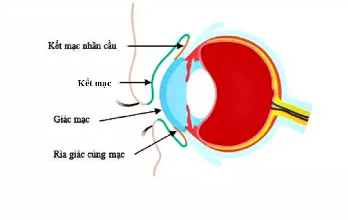 Kết mạc là lớp mỏng bao phủ trên bề mặt nhãn cầu (Ảnh: Internet). Kết mạc là lớp mỏng bao phủ trên bề mặt nhãn cầu (Ảnh: Internet).