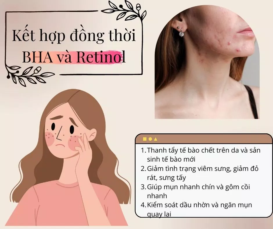 BHA và Retinol chinh là bộ đôi hoàn hảo giúp da khắc phục được nhiều vấn đề từ loại bỏ da chết, tăng sinh tế bào mới cho đến giảm sưng viêm (nguồn: BlogAnChoi)