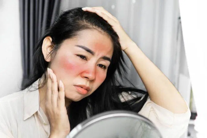 Bạn phải kiểm tra bảng thành phần kỹ càng trước khi quyết định mua các loại kem dưỡng hoặc đồ trang điểm cho da bị Eczema (Ảnh: Internet)
