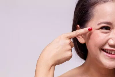 Nếp nhăn có thể hình thành từ nhiều lí do khác nhau (Ảnh: Internet)
