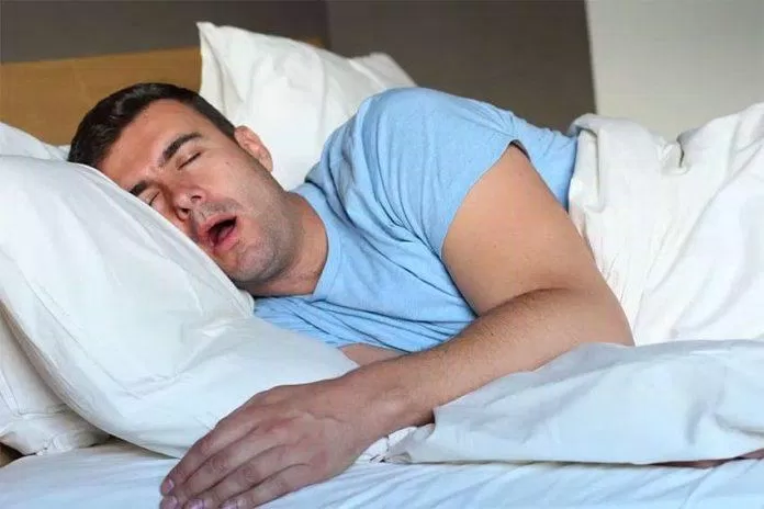 Ngưng thở xảy ra trong lúc ngủ khiến giấc ngủ bị ngắt quãng và không sâu (Ảnh: Internet)