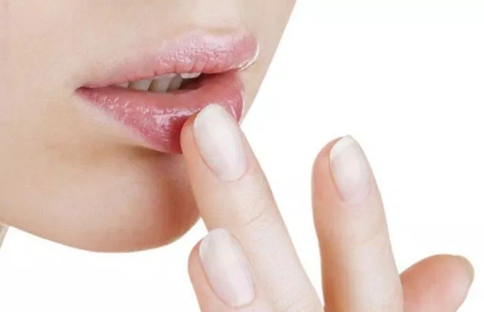 Son dưỡng nếu lan ra vùng da quanh miệng sẽ khiến tình trạng bít tắc xuất hiện (Ảnh: Internet).