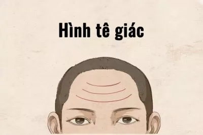 Nhân tướng học: Nếp nhăn trán hình tê giác (Ảnh: Internet)