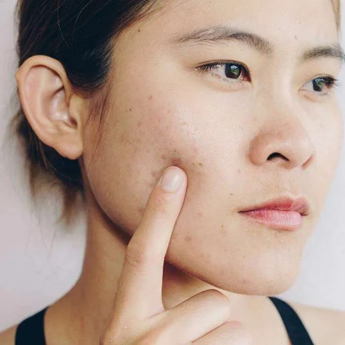Những chai serum được thiết kế riêng cho một loại da cụ thể, ví dụ như da sần sùi và không đều màu. (Nguồn: Internet).