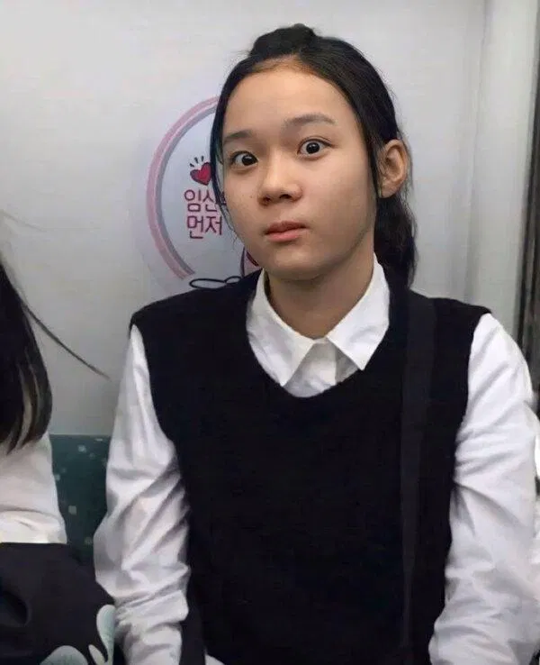 Trước đây, nữ thần tượng dường như có sống mũi thấp hơn và tổng thể mũi to hơn. Trước đây, nữ thần tượng dường như có sống mũi thấp hơn và tổng thể mũi to hơn.