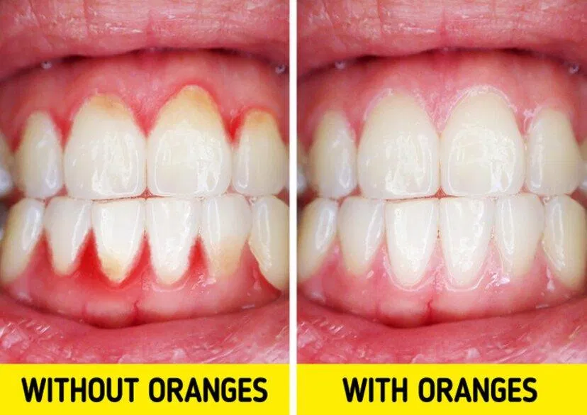 Ích lợi của cam cho sức khỏe (Ảnh: Internet)