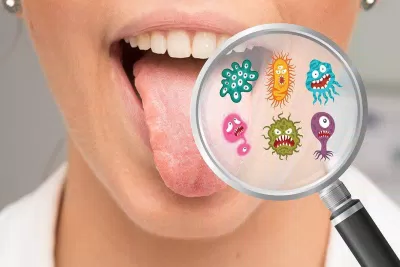 Trong miệng có rất nhiều vi khuẩn tồn tại, kể cả trên lưỡi (Ảnh: Internet) Trong miệng có rất nhiều vi khuẩn tồn tại, kể cả trên lưỡi (Ảnh: Internet)