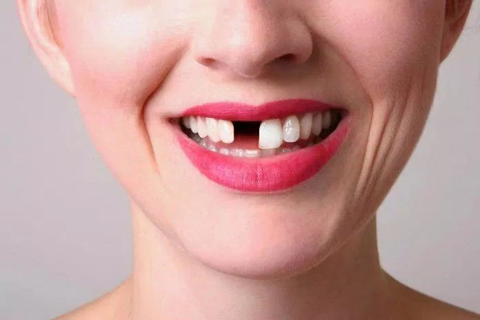 Giải mã giấc mơ rụng răng cửa là điềm báo người thân sắp gặp họa, qua đời. (Ảnh: Internet)