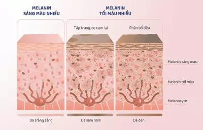 ( Nguồn: Internet )