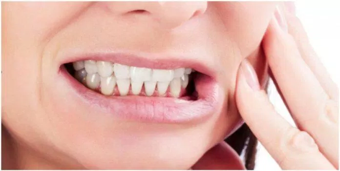 Răng có thể bị hư hại đến mức dễ nhìn thấy (Ảnh: Internet)