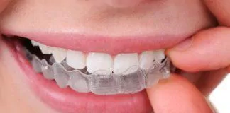 Các dụng cụ được chế tạo để ngăn nghiến răng (Ảnh: Internet)