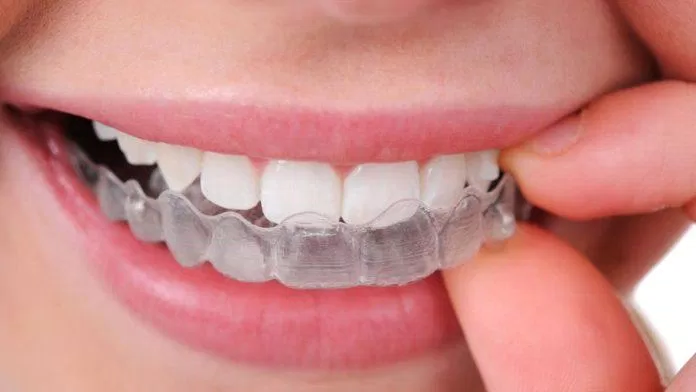 Các dụng cụ được chế tạo để ngăn nghiến răng (Ảnh: Internet)