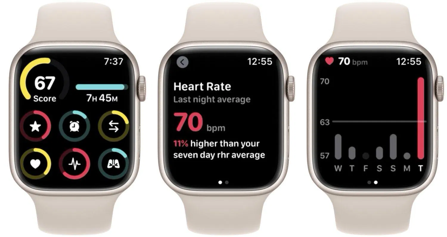 Ứng dụng theo dõi giấc ngủ Sleep Details cho Apple Watch (Ảnh: Internet) Ứng dụng theo dõi giấc ngủ Sleep Details cho Apple Watch (Ảnh: Internet)