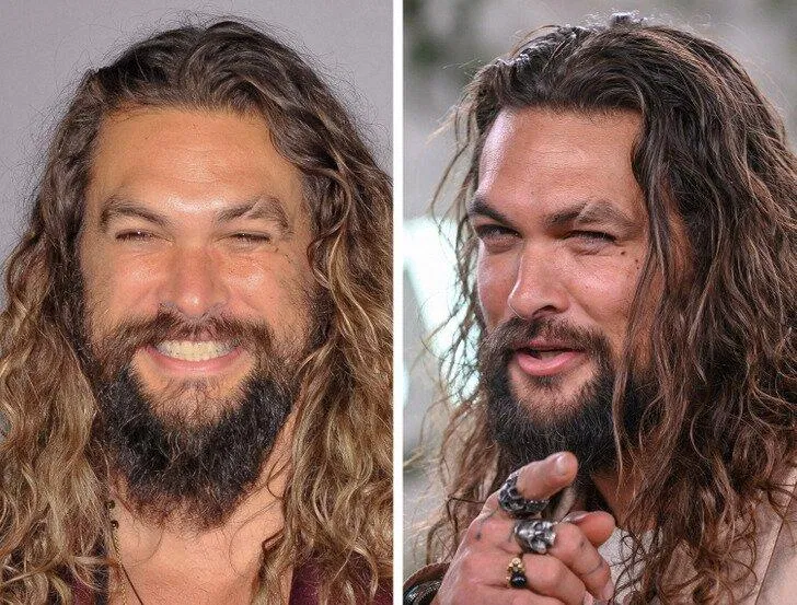 Những người có sẹo trên khuôn mặt thu hút trong việc hẹn hò nhưng lại không được ưa chuộng khi kết hôn (Ảnh: Internet)