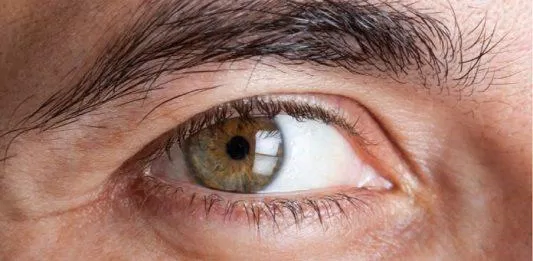 Bệnh mắt (Ảnh: Internet)