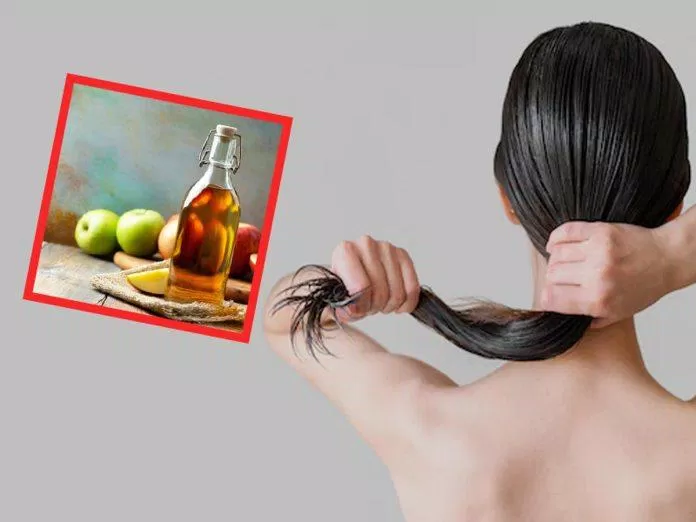 Giấm táo giúp tóc khỏe và sạch gàu (Nguồn: Internet).
