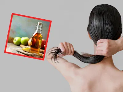 Giấm táo giúp tóc khỏe và sạch gàu (Nguồn: Internet). Giấm táo giúp tóc khỏe và sạch gàu (Nguồn: Internet).