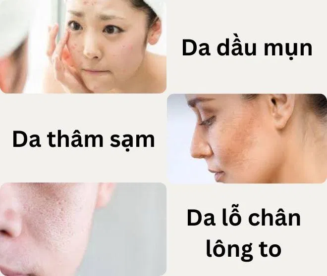 Các đối tượng nên sử dụng kết hợp BHA và Niacinamide. (Nguồn ảnh: BlogAnChoi)