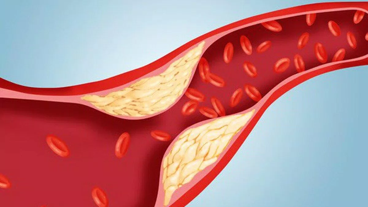 Tảo xoắn giúp giảm mỡ máu (Nguồn: Internet). Tảo xoắn giúp giảm mỡ máu (Nguồn: Internet).