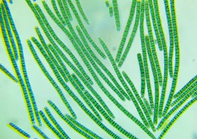 Vi khuẩn Cyanobacterium (Nguồn: Internet). Vi khuẩn Cyanobacterium (Nguồn: Internet).