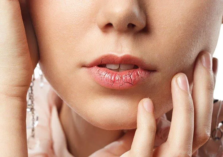 Sử dụng những thỏi son không rõ nguồn gốc có khả năng khiến bạn bị dị ứng son (Ảnh: internet).