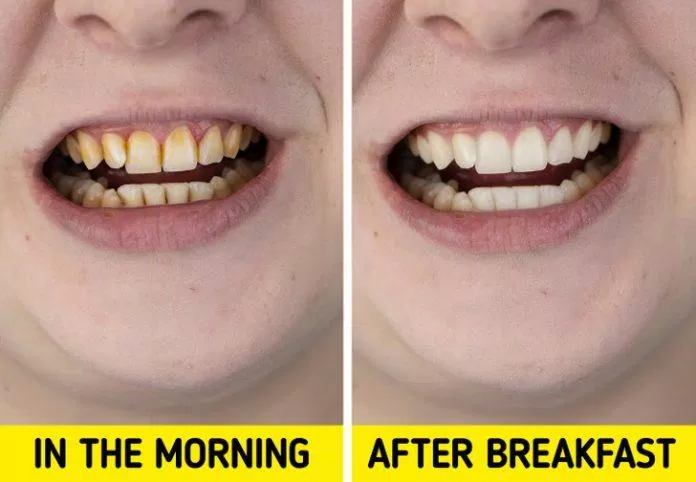 Ăn uống sau khi đánh răng khiến lớp florua bảo vệ trong kem đánh răng bị trôi đi (Ảnh: Internet)