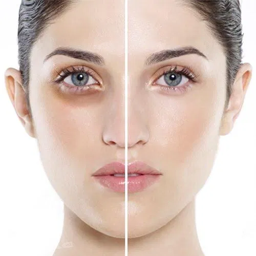 Kem trị thâm mắt là sản phẩm không thể thiếu của các chị em để có đôi mắt sáng khỏe long lanh