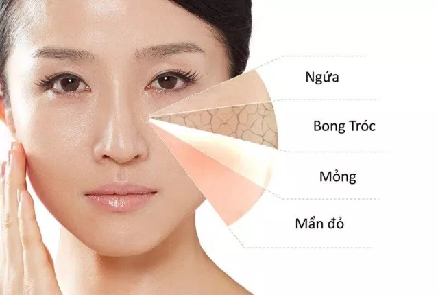 Với những bạn da nứt nẻ, bong tróc thì bất cứ loại serum tái tạo nào cũng có thể hỗ trợ các bạn nhé (Ảnh: internet)