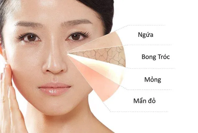 Với những bạn da nứt nẻ, bong tróc thì bất cứ loại serum tái tạo nào cũng có thể hỗ trợ các bạn nhé (Ảnh: internet)