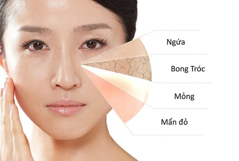Với những bạn da nứt nẻ, bong tróc thì bất cứ loại serum tái tạo nào cũng có thể hỗ trợ các bạn nhé (Ảnh: internet)