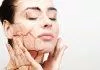 5 công thức trị mụn cho da khô tại nhà an toàn và hiệu quả